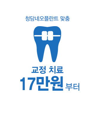 청담네오플란트 맞춤 교정치료 17만원부터